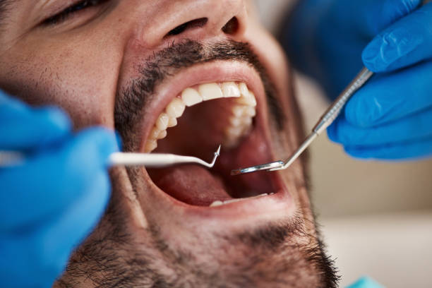 Best Emergency Tooth Extraction in Cedville, AR