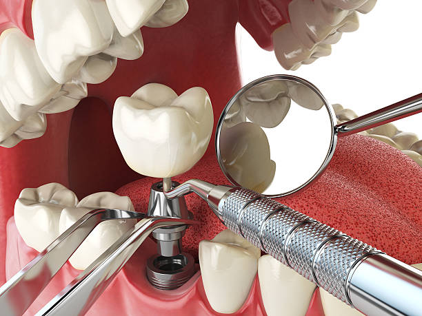 Best Emergency Treatment for Toothache in Cedville, AR